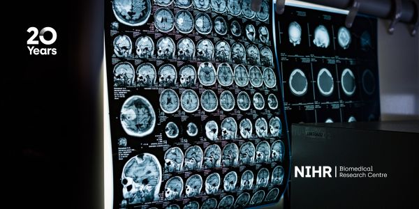 Oxford study reveals how an ‘allergy’ chemical influences memory and learning from setbacks
